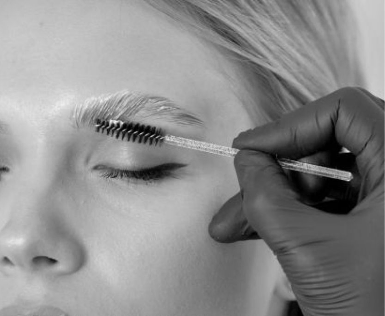 Brow Lift