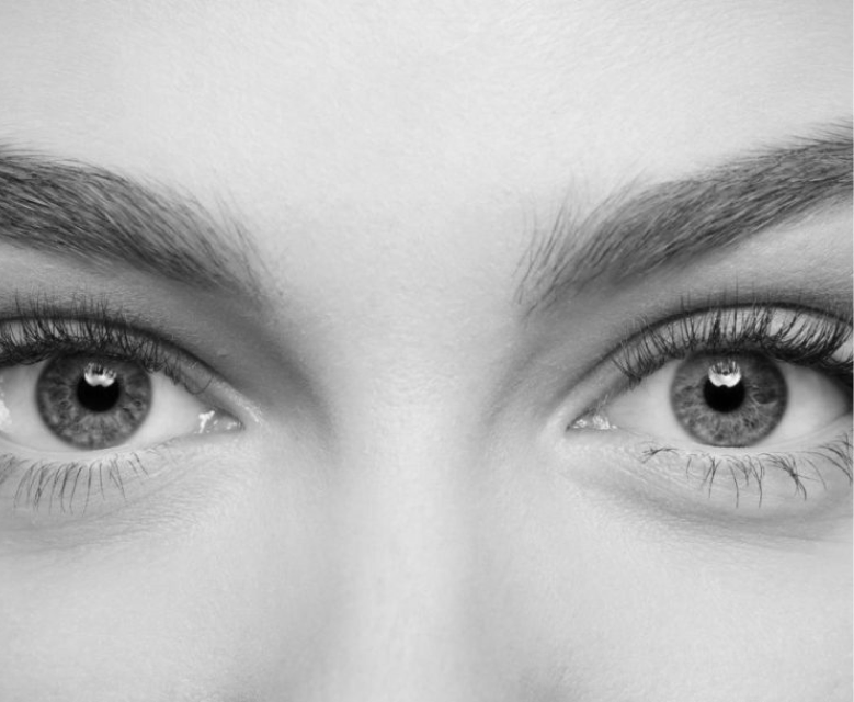 Lower Blepharoplasty