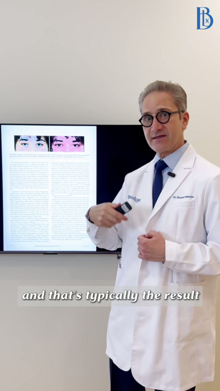Conjunctiva-sparing ptosis repair video 3