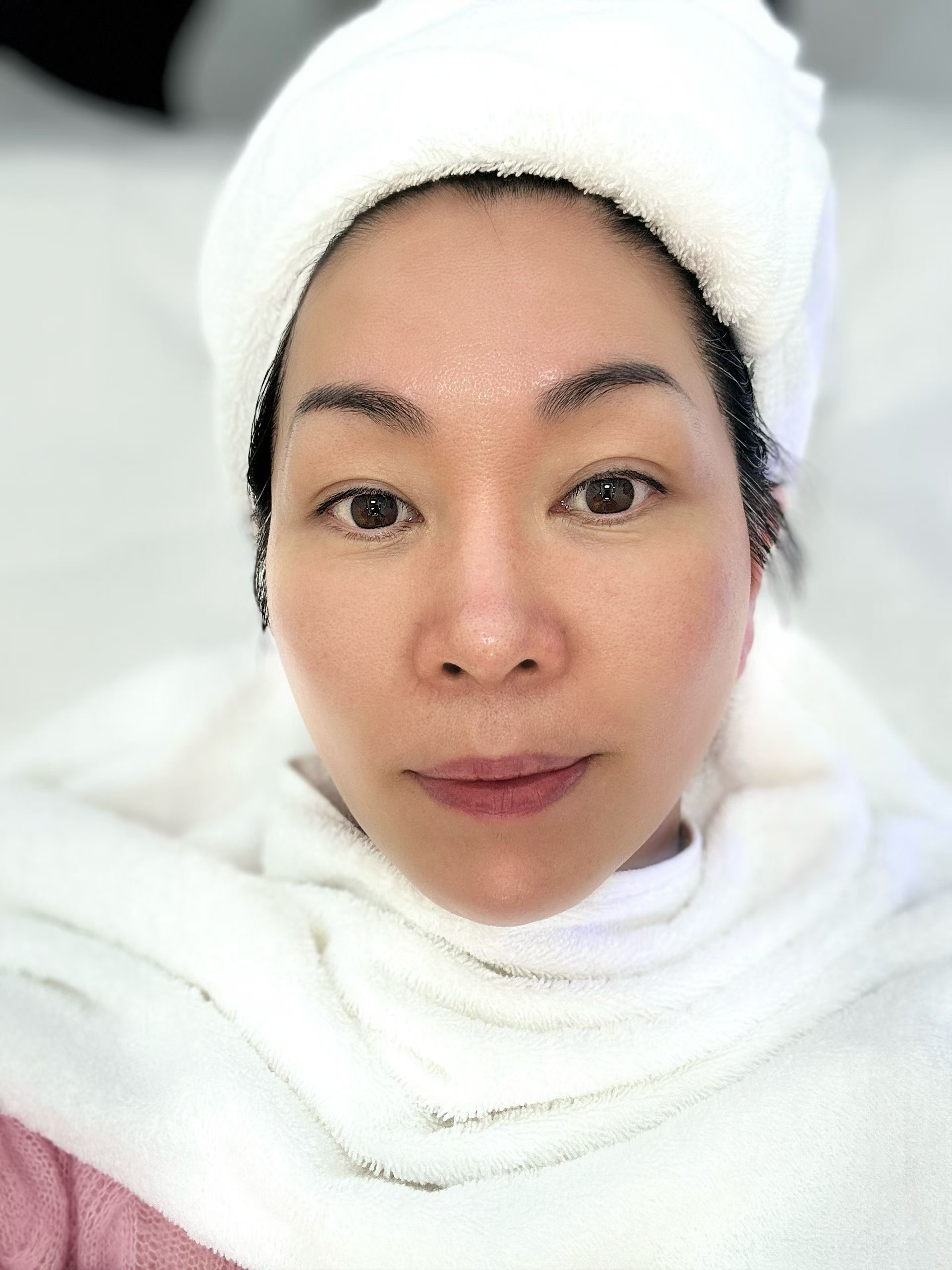 Non Surgical Skin Rejuvenation